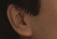Listening